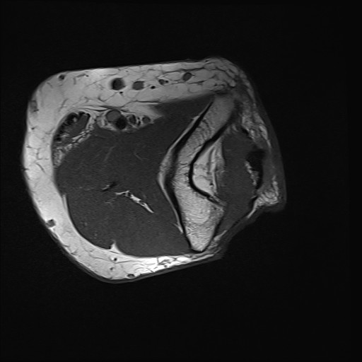 Click on the Serie image to view the images of Wieszt, Gnter